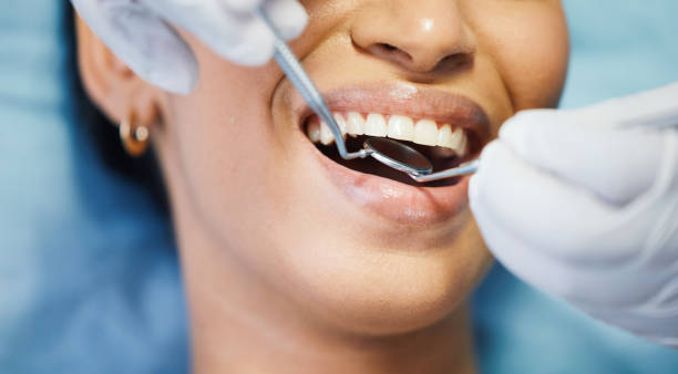 Best Chipped Tooth Repair Near Me  in Southport, CT